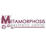 metamorphosis-a-c